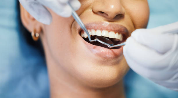 Best Emergency Treatment for Toothache in Los Gatos, CA